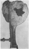152-4