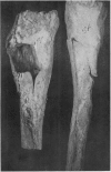 148-1
