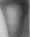 164-1