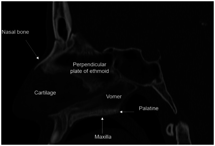 Figure 2.