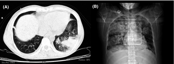 FIGURE 2