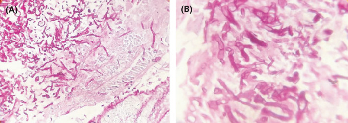 FIGURE 4