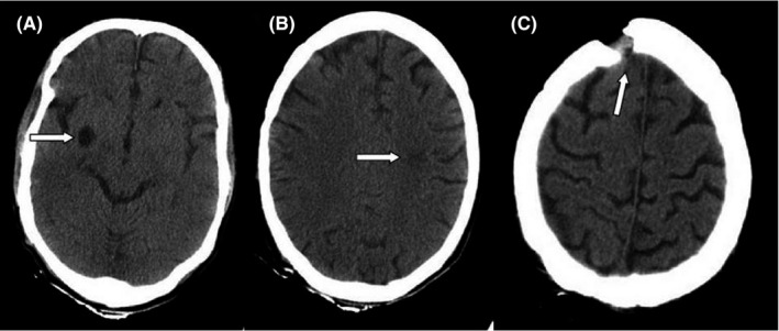 FIGURE 1