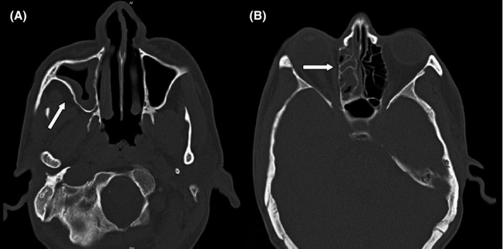 FIGURE 3