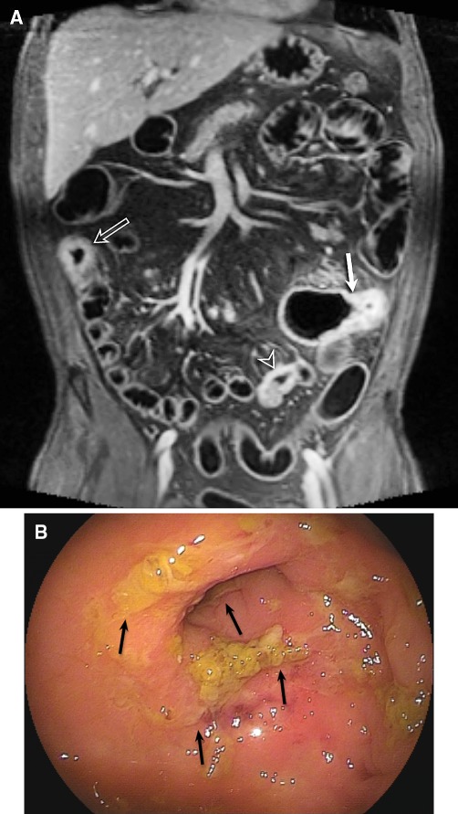 Fig. 1