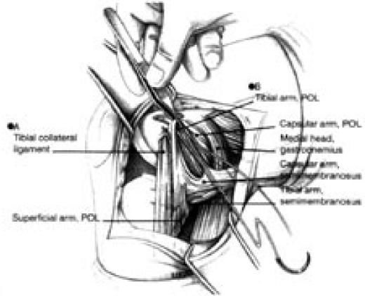 Figure 9a