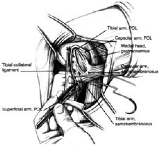 Figure 9b