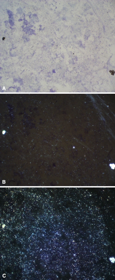 Fig. 4A–C