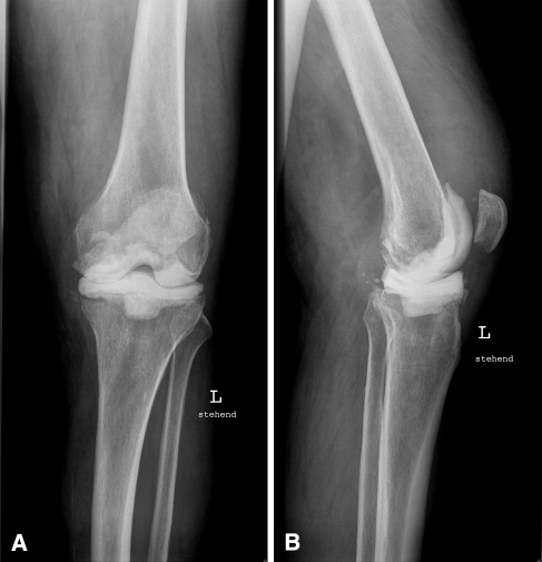 Fig. 2A–B