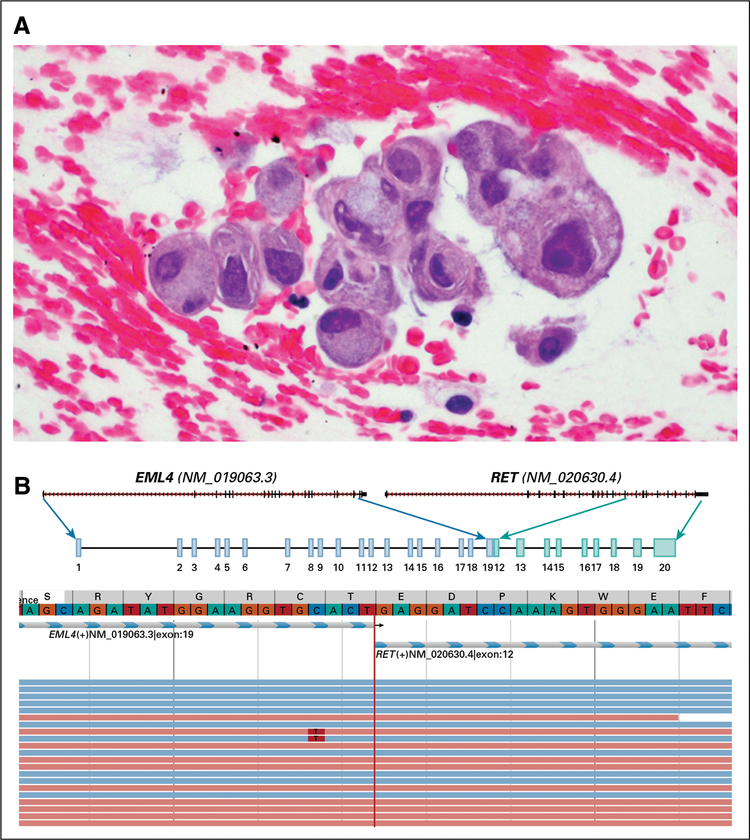 FIG 1.