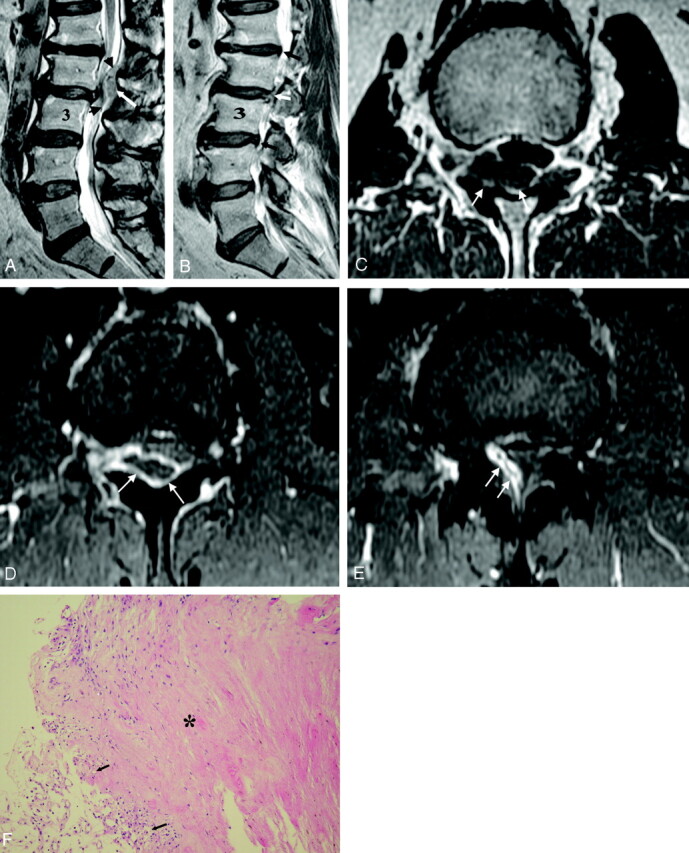 Fig 1.