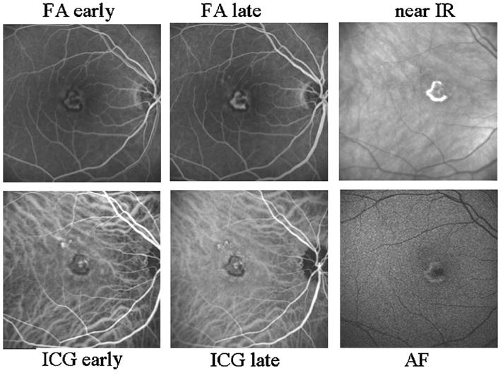 Fig. 10