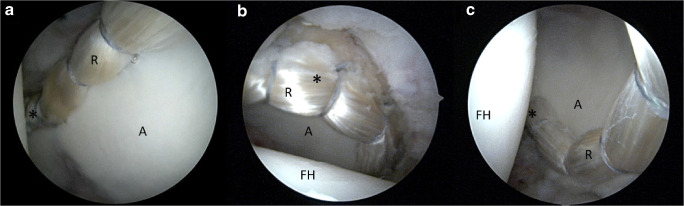 Fig. 5