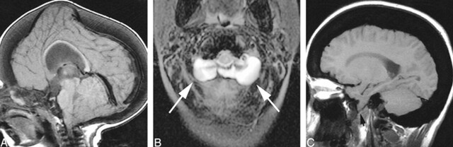 fig 4.