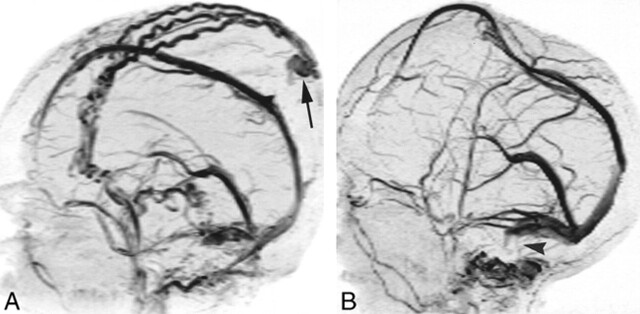 fig 3.