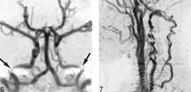 fig 6.