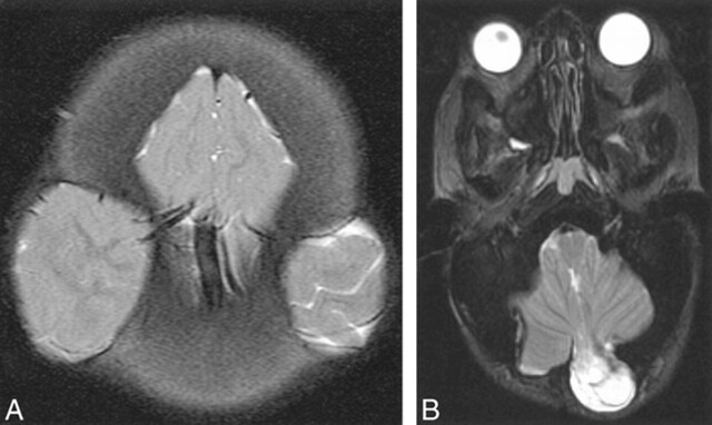 fig 5.