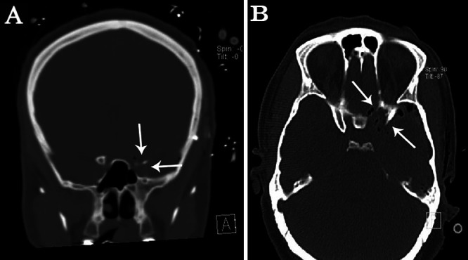 FIG. 3.