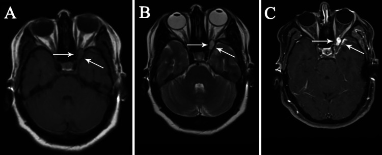 FIG. 2.