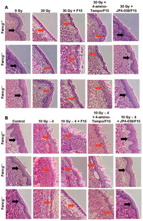 FIG. 4