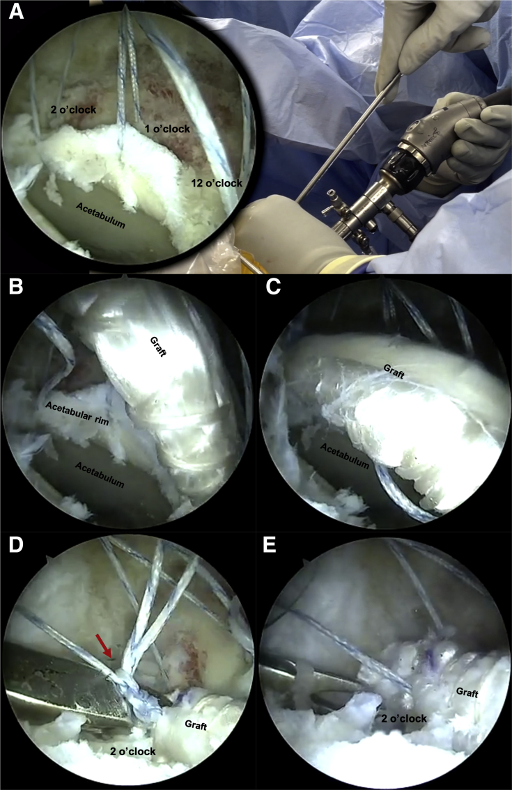 Fig 6