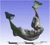 Fig. 1b
