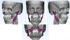 Fig. 1a