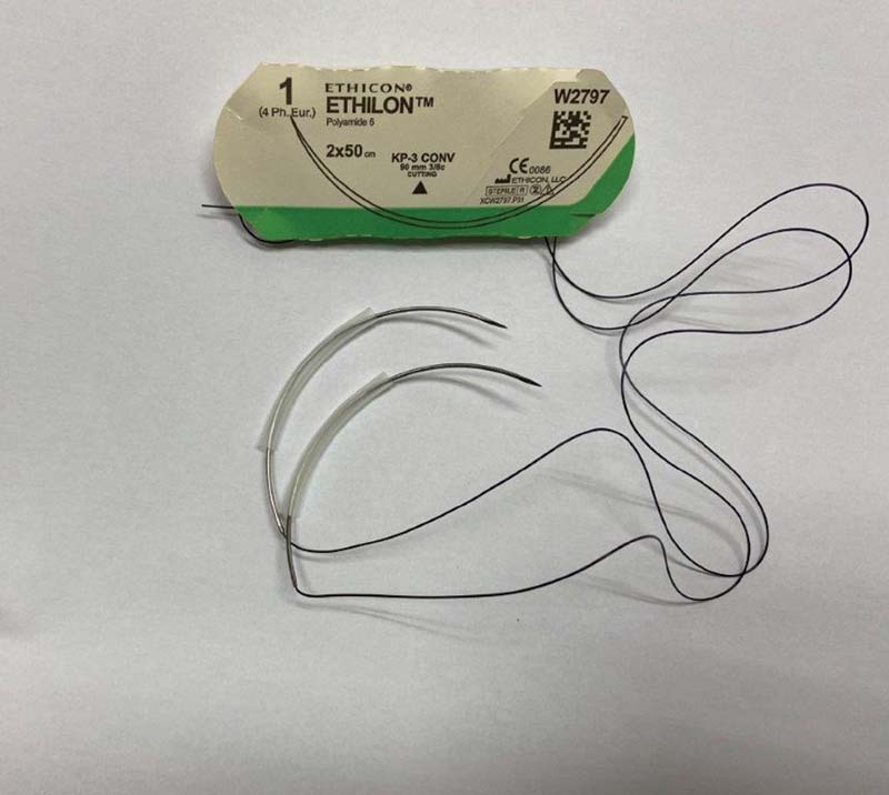 Fig. 2