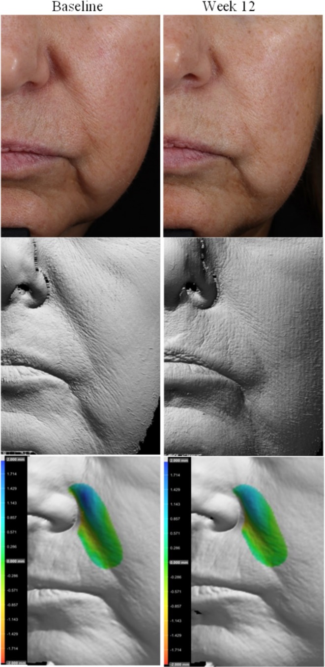 FIGURE 4