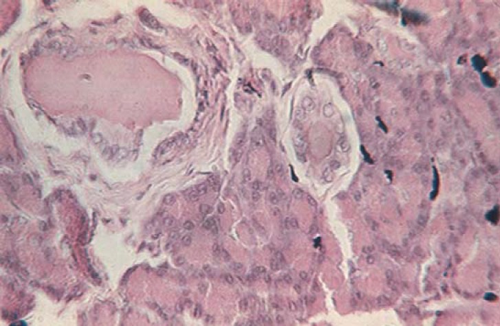 Fig. 14