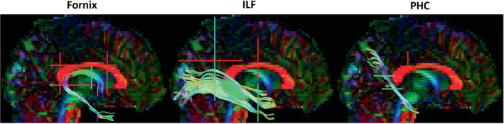 FIGURE 3