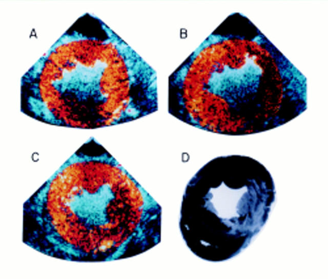 Figure 1  