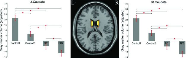 Fig 2.