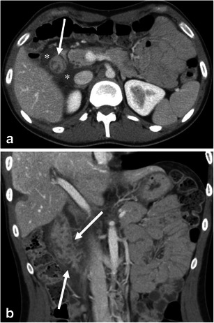 Fig. 9