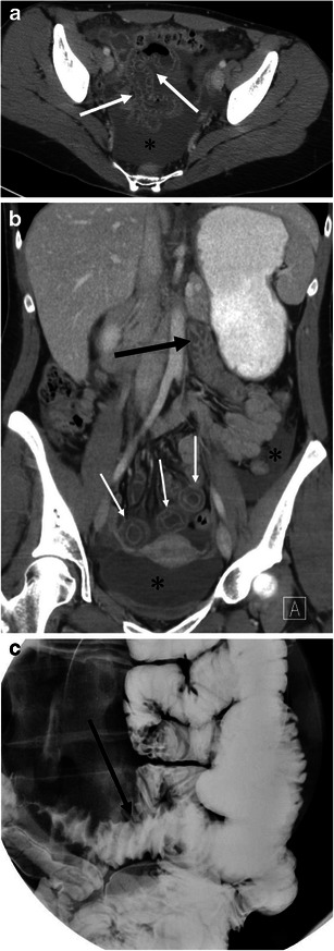 Fig. 11