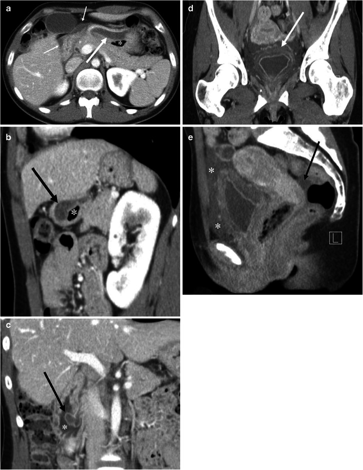 Fig. 10