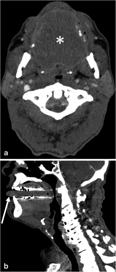 Fig. 8