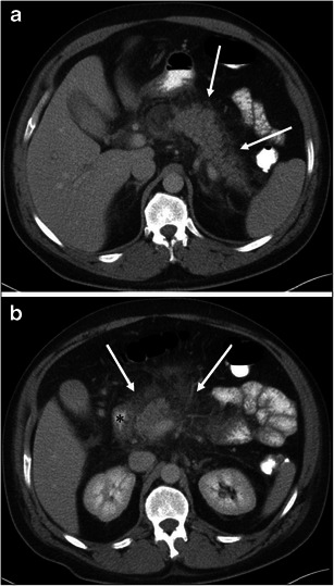 Fig. 12