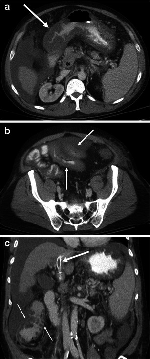 Fig. 13