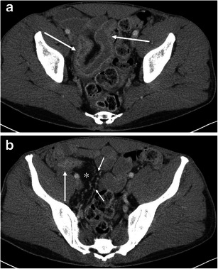 Fig. 14