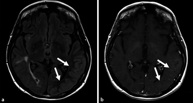 graphic file with name 115_2022_1413_Fig1_HTML.jpg