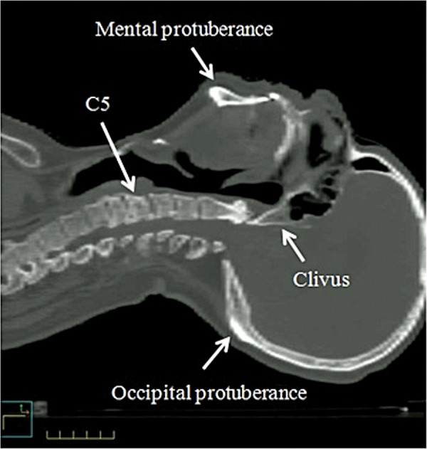 Fig. 2.