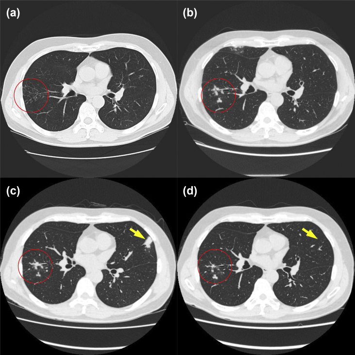 Fig. 1