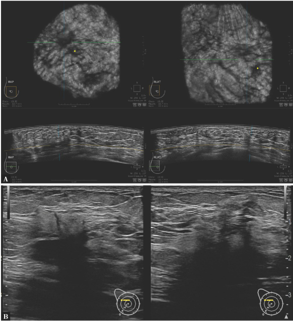 Fig. 10