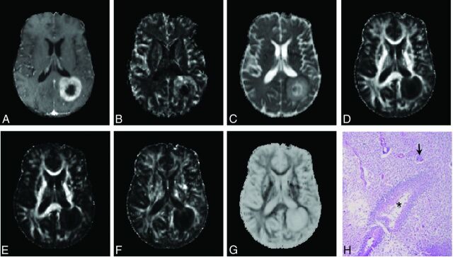 Fig 3.