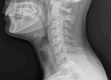 Figure 1b