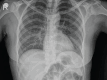Figure 1c