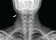 Figure 1a