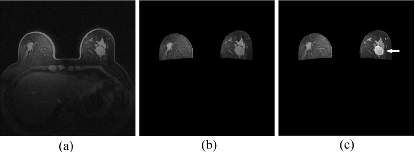 FIG. 1.