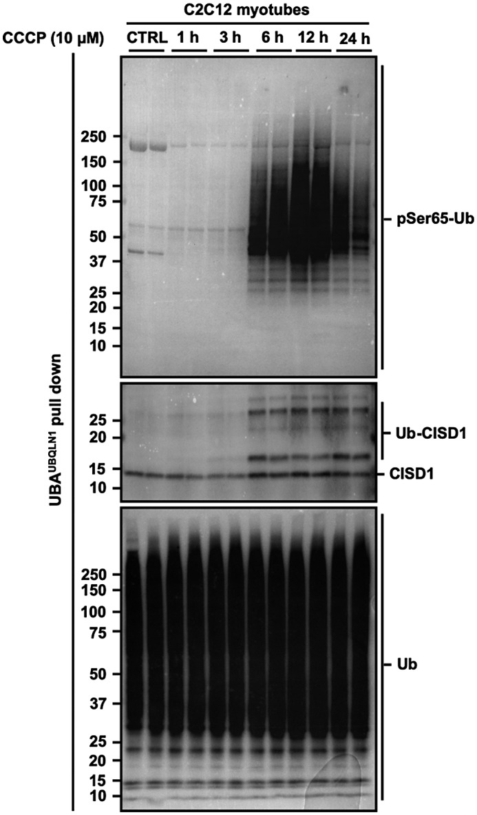 AMPK activation induces mitophagy and promotes mitochondrial fission ...